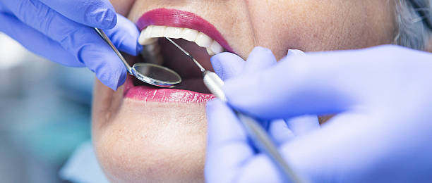 Best Emergency Dentist for Lost Fillings or Crowns in Myrtle Grove, FL